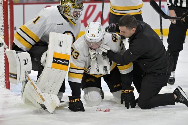 Bruins D Charlie McAvoy has facial surgery, out indefinitely